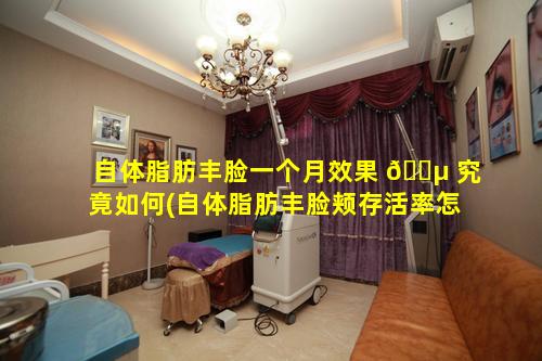 自体脂肪丰脸一个月效果 🐵 究竟如何(自体脂肪丰脸颊存活率怎么样)